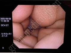 OLYMPUS Video Gastroscope