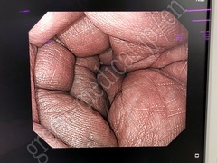 OLYMPUS Processor & Xenon Lightsource