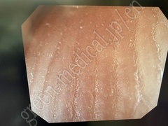 OLYMPUS Video Gastroscope