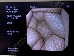 OLYMPUS Processor & Light Source