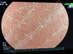 FUJIFILM Video Colonoscope