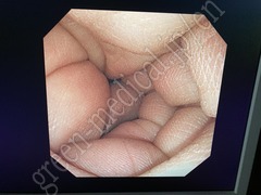 OLYMPUS Processor & Xenon Lightsource