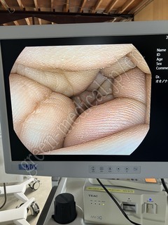 PENTAX Video Processor & Light Source