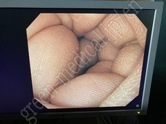 OLYMPUS Processor & Xenon Lightsource