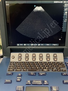 SonoSite Ultrasound Color Doppler