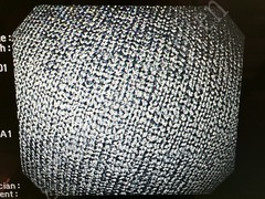 OLYMPUS Video Gastroscope