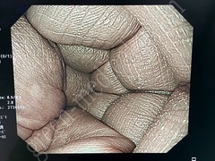 OLYMPUS Processor & Xenon Lightsource