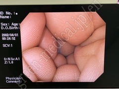 OLYMPUS Video Gastroscope