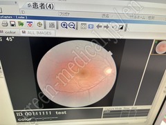 TOPCON Fundus Camera