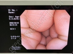 OLYMPUS Video Colonoscope