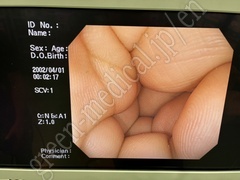 OLYMPUS Video Colonoscope