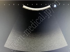 SAMSUNG MEDISON CO.,LTD Diagnostic Ultrasound System