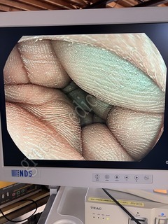 PENTAX Video Processor & Light Source