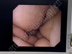 OLYMPUS Video Gastroscope