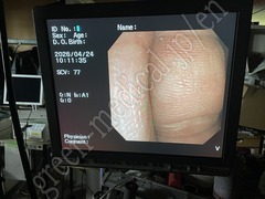 OLYMPUS Video Duodenoscope