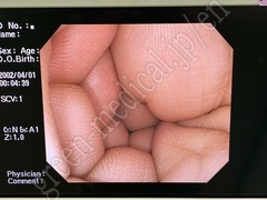 OLYMPUS Video Colonoscope