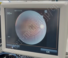 TOPCON Fundus Camera