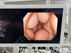OLYMPUS Video Colonoscope