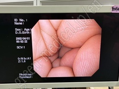 OLYMPUS Video Gastroscope