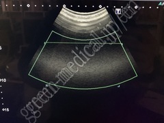 TOSHIBA Ultrasound Color Doppler