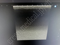 SAMSUNG MEDISON CO.,LTD Diagnostic Ultrasound System