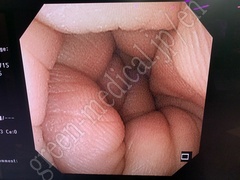 OLYMPUS Nasal Gastroscope