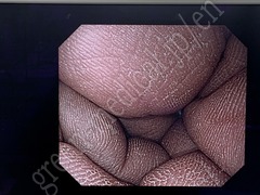 OLYMPUS Processor & Xenon Lightsource