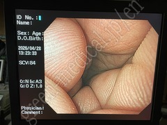 OLYMPUS Video Gastroscope
