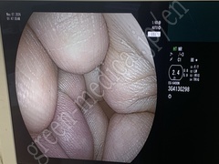 FUJIFILM Processor & Light Source