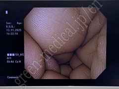 OLYMPUS Processor & Xenon Lightsource