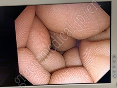 OLYMPUS Processor & Xenon Lightsource