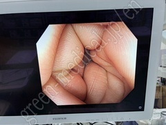 OLYMPUS Video Colonoscope