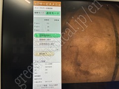FUJIFILM Video Transnasal Gastroscope
