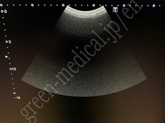 TOSHIBA Ultrasound Color Doppler