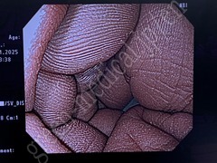 OLYMPUS Processor & Xenon Lightsource