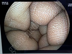 FUJIFILM Processor & LED Light Source