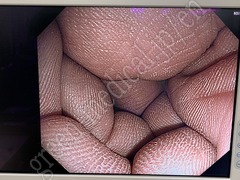 OLYMPUS Processor & Xenon Lightsource