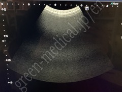 TOSHIBA Ultrasound Color Doppler