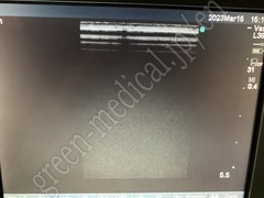 SonoSite Portable Ultrasound Color Doppler