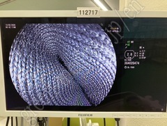 FUJIFILM Video Gastroscope