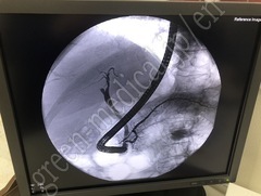 Dornier Medtech Systems Lithotripter