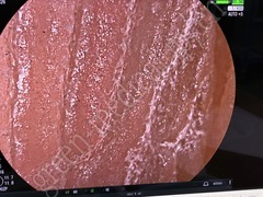 FUJIFILM Video Colonoscope
