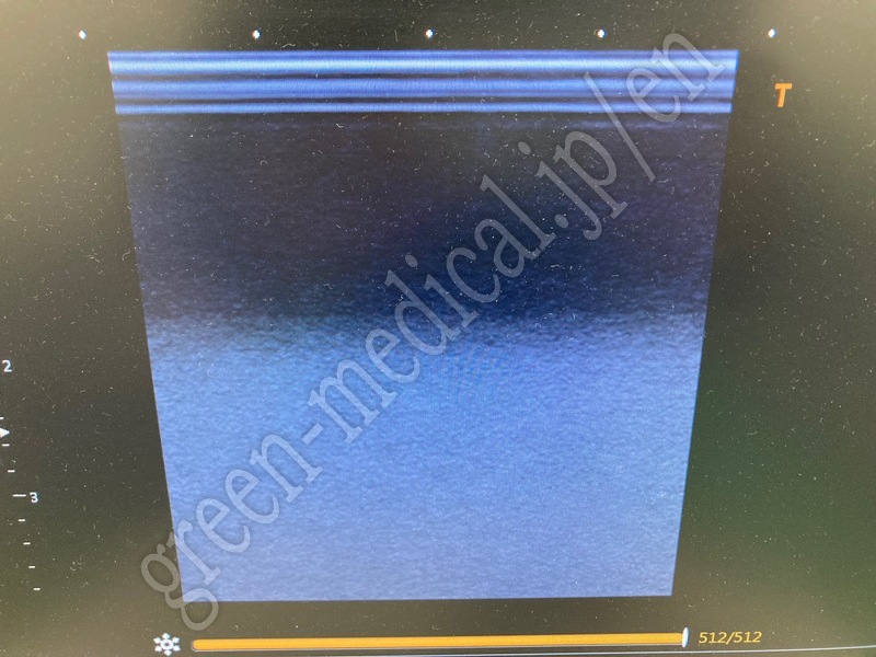 4.〇 超音波診断装置