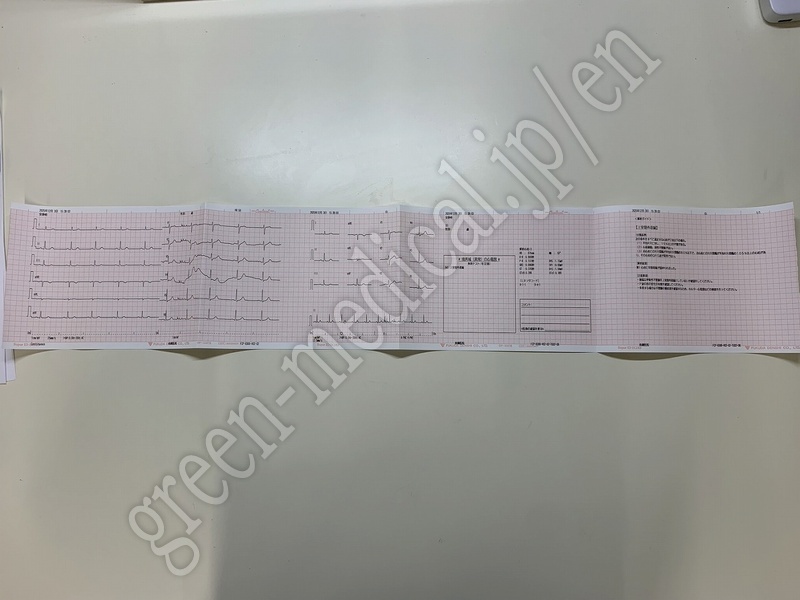4.○ 解析機能付心電計