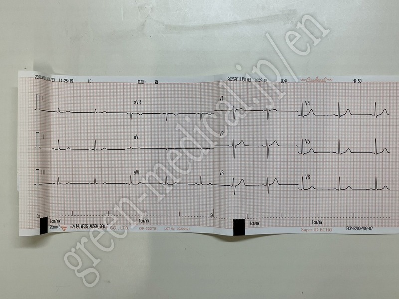 4.〇 解析付心電計