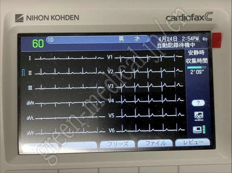 4.〇心電計