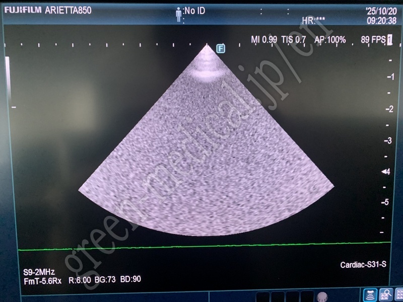 5.【動物病院向け】超音波診断装置