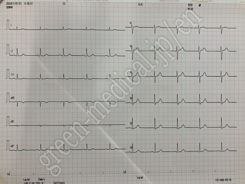 5.○多機能心電計