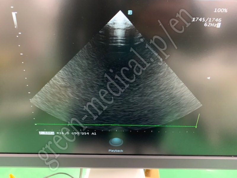 5.○超音波診断装置(カラードプラ)