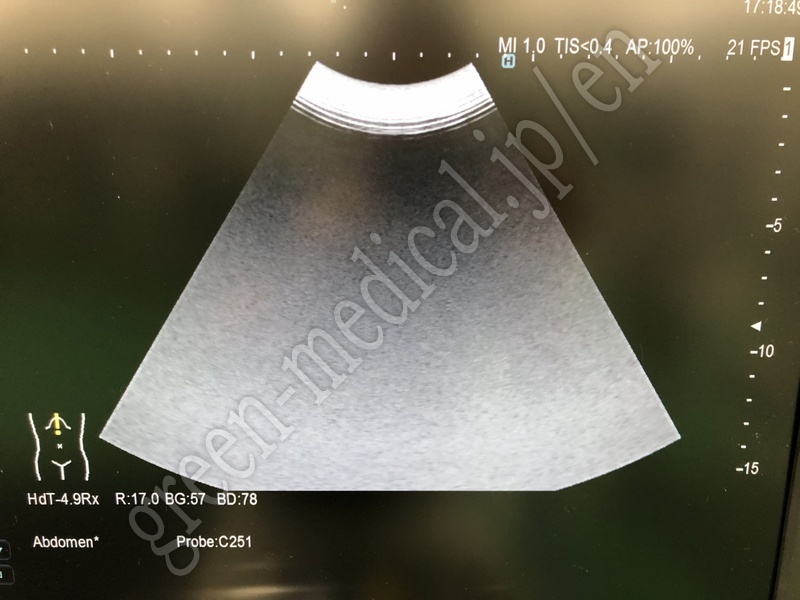 6.○超音波診断装置